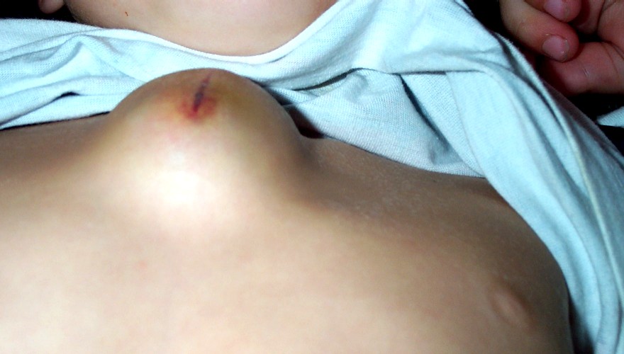 chest-11.27.04.jpg